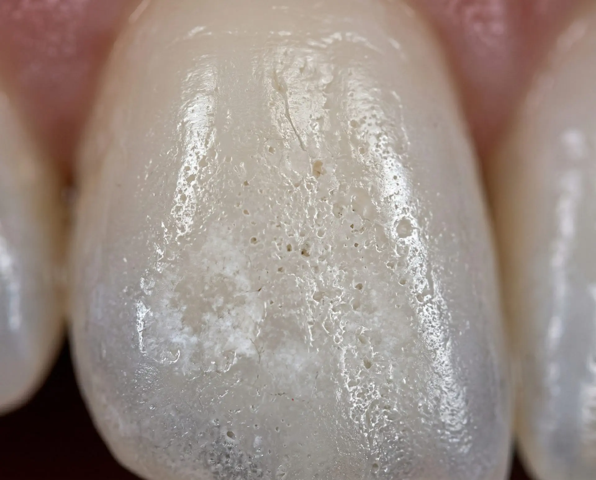 best hydroxyapatite toothpaste 1
